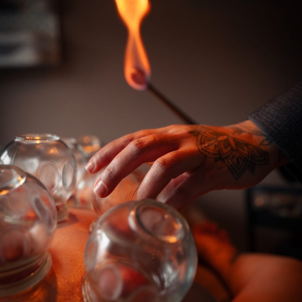 Vuurcuppen behandeling waarbij glazen cups met behulp van een vlam op de huid worden geplaatst